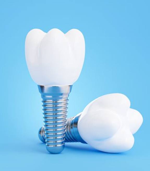 Two dental implants and crowns against blue background