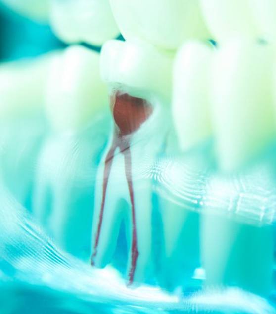 A plastic model with red dental roots visible