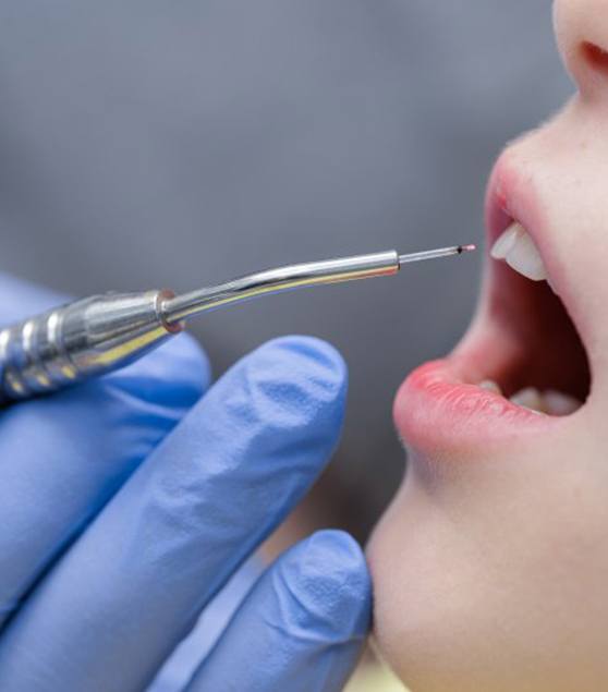 Close up of dentist using a dental laser for a gingivectomy 