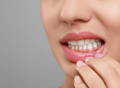 a patient showing off her healthy teeth and gums 