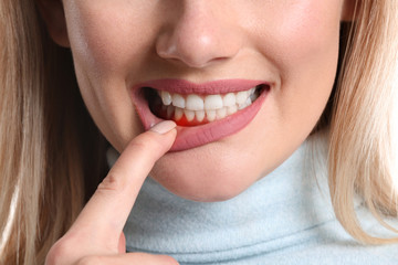 patient with gum disease pointing to gums